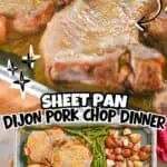 Juicy Dijon sheet pan pork chops with potatoes and green beans on a baking sheet.